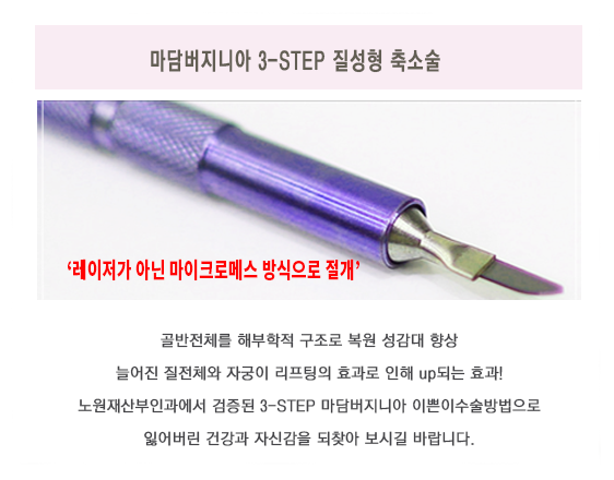 마담버지니아 3-STEP 질성형 축소술