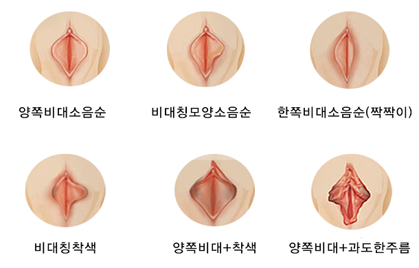 소음순 이미지