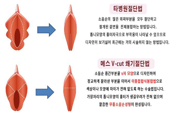 절단법 비교